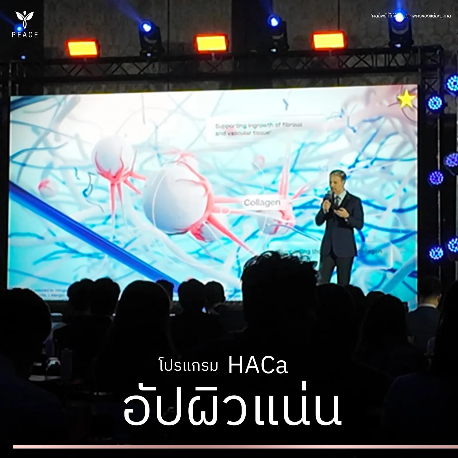 HArmonyCa — โปรแกรมอัปผิวแน่นแบบดูโอ้