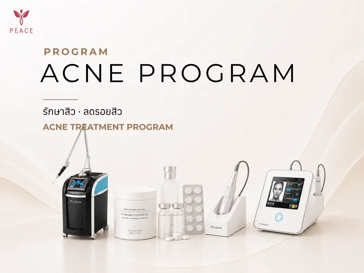 Acne Program ที่ Peace Clinic แม่สอด