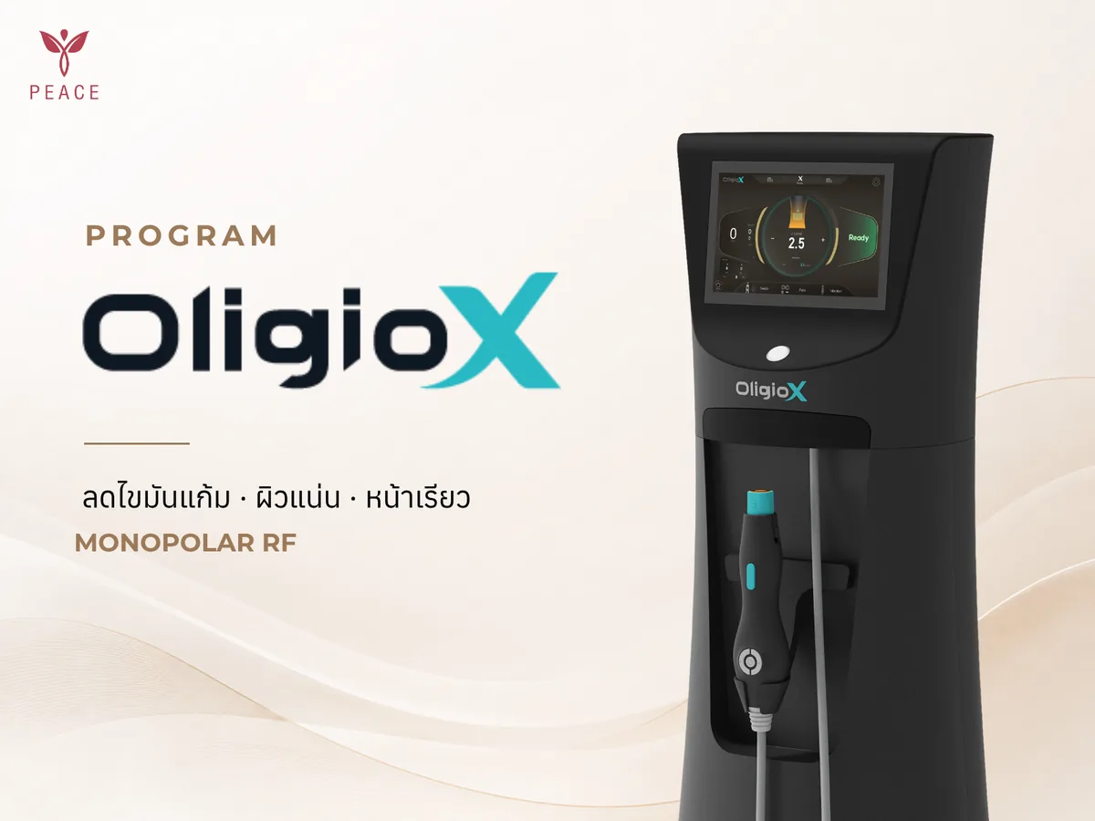 Oligio X ที่ Peace Clinic แม่สอด