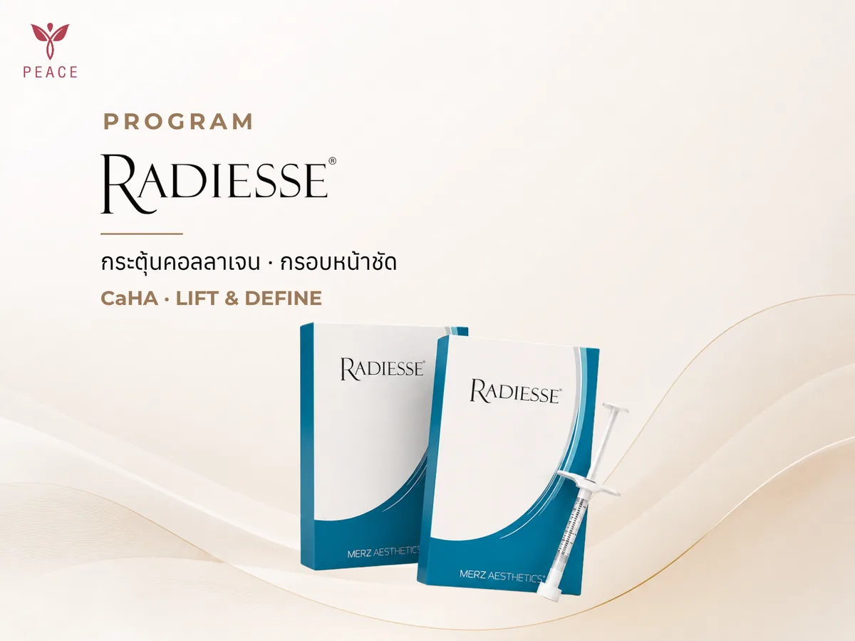 Radiesse ที่ Peace Clinic แม่สอด